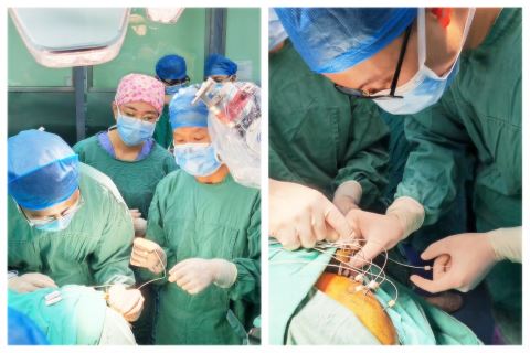 16导脑电图怎么放置揭阳市人民医院顺利开展粤东首例机器人辅助下立体定向脑电图术（SEEG）及其引导下 射频热凝术_https://www.jmylbn.com_新闻资讯_第1张